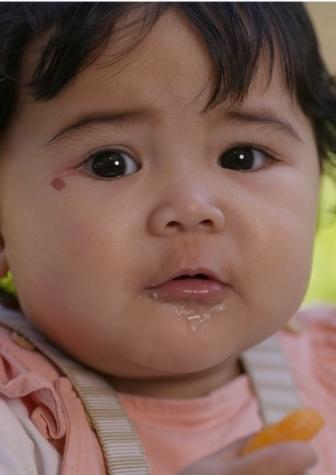Feeding
